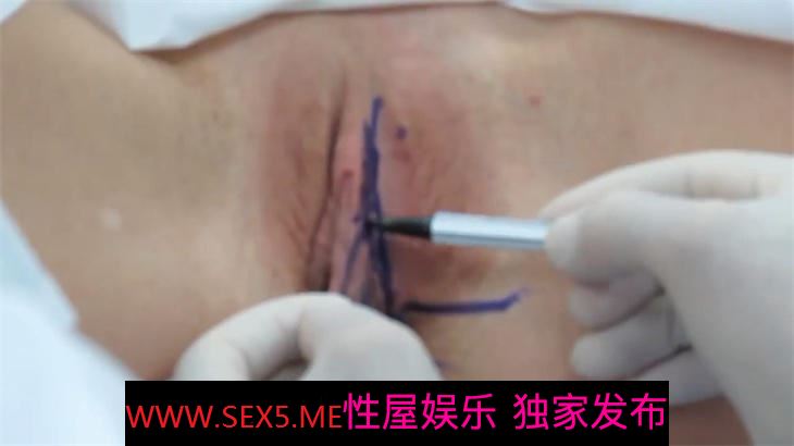 [MP4/395M] 【极品稀缺❤️大开眼界】带你见识阴唇整形 阴道缩紧 修复处女膜 满足你的好奇心 带你Get新知识 珍奇科普资源